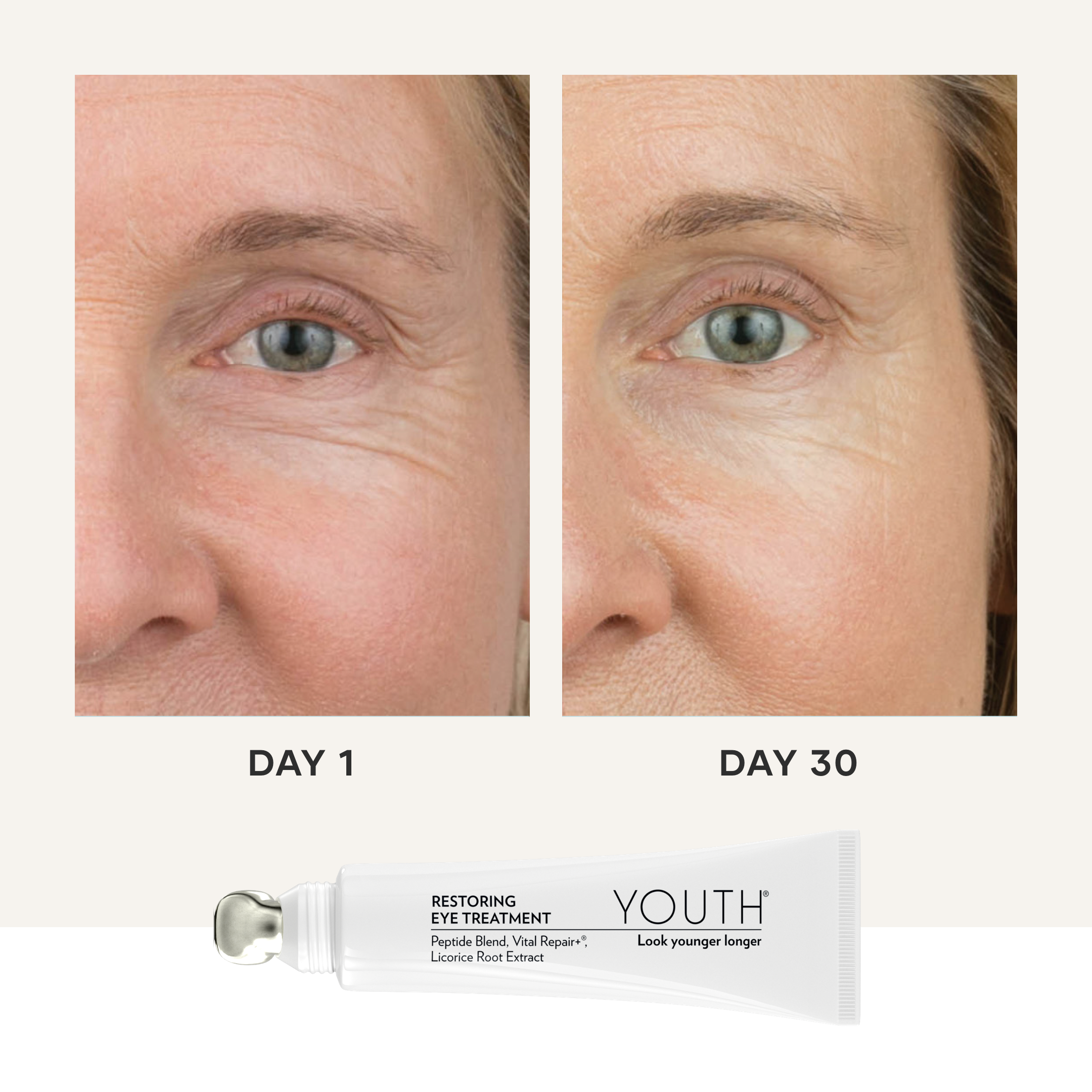 shaklee eye treatment - Shaklees shaklee eye treatment