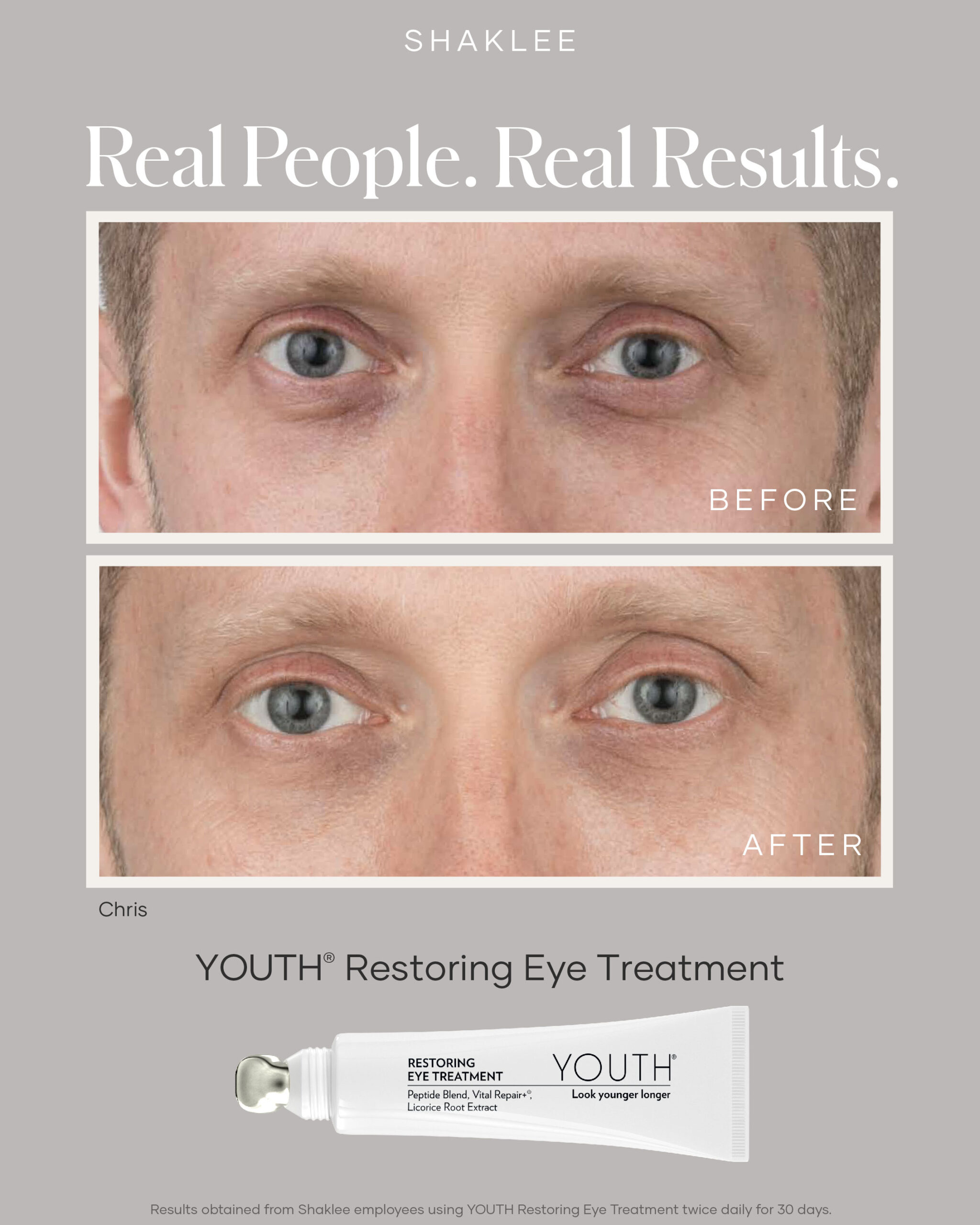 shaklee eye treatment - Shaklees shaklee eye treatment