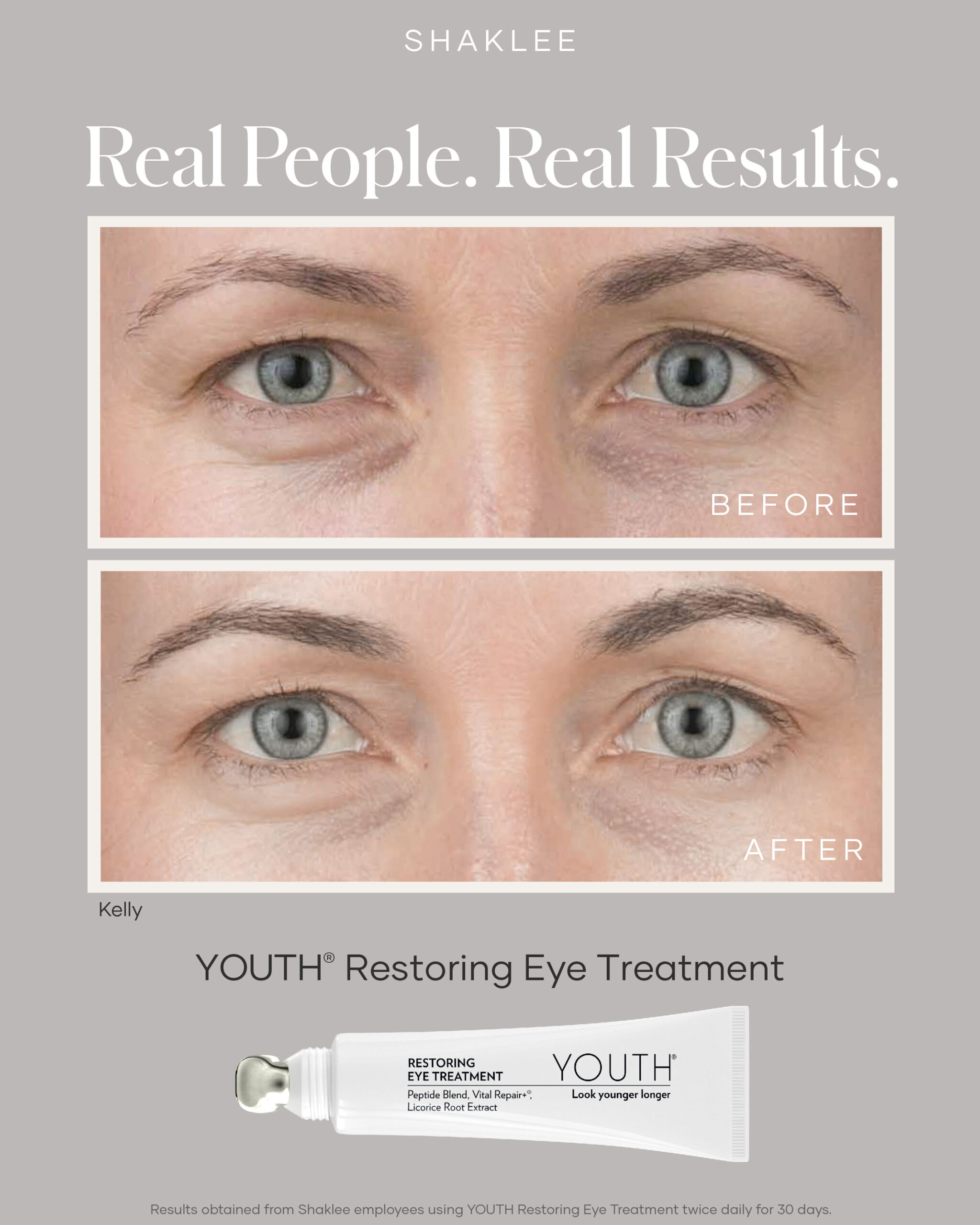 shaklee eye treatment - Shaklees shaklee eye treatment