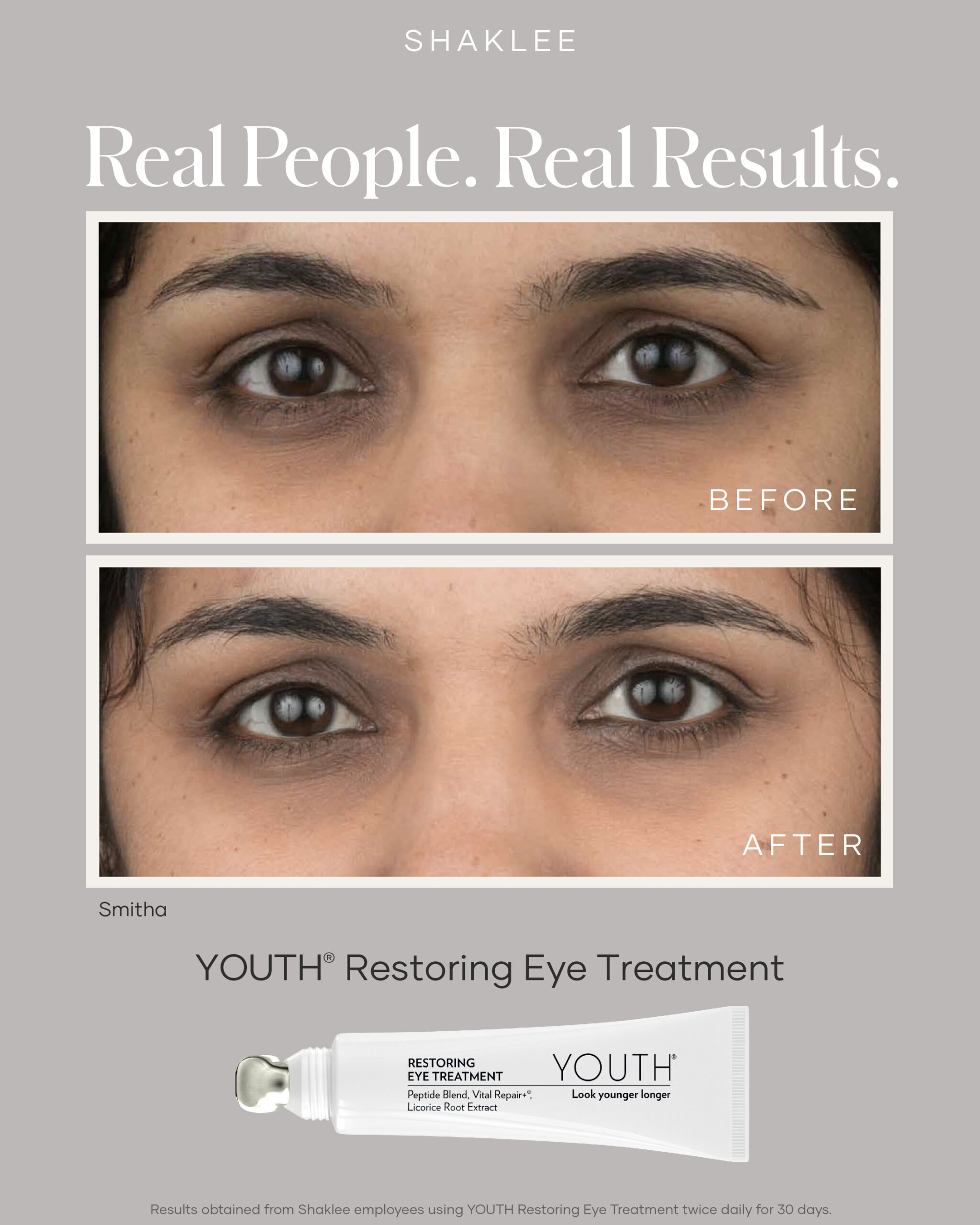 shaklee eye treatment - Shaklees shaklee eye treatment